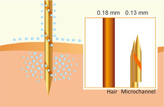 Aquagold® Micronchannels