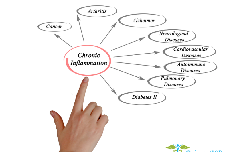 This image features a hand pointing to a diagram that illustrates the impact of chronic inflammation on various health conditions. At the center is an oval labeled "Chronic Inflammation," with arrows pointing to a series of ovals around it, each containing the name of a different health condition affected by chronic inflammation. These conditions include Arthritis, Alzheimer's, Neurological Diseases, Cardiovascular Diseases, Autoimmune Diseases, Pulmonary Diseases, Diabetes II, and Cancer. The diagram signifies the central role of chronic inflammation in contributing to these diverse health issues. Below the diagram, the logo of Rejeune MD Wellness & Aesthetics, which includes a stylized representation of a green caduceus and the text "Rejeune MD Wellness & Aesthetics," indicates the creator or owner of this educational image.